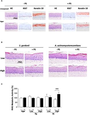 Stable reconstructed human gingiva–microbe interaction model: Differential response to commensals and pathogens